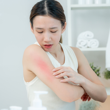 The Hidden Reason Sensitive Skin Is So Common in Malaysia (It’s Not Skincare)