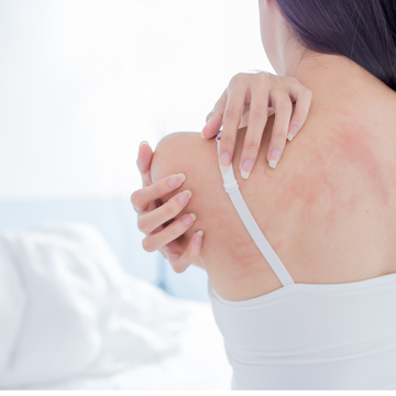 Eczema & Your Bedsheets: What Most People Don’t Realize