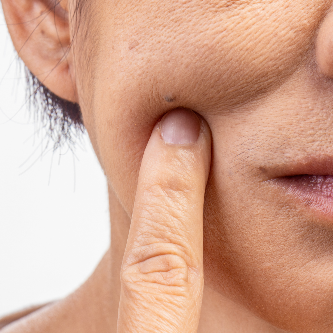 The Hidden Skin Barrier Damage Caused by Cheap Bedsheets